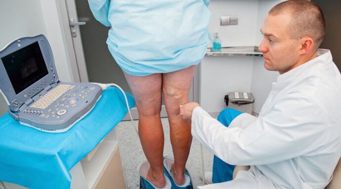 Varicose vein diagnosis