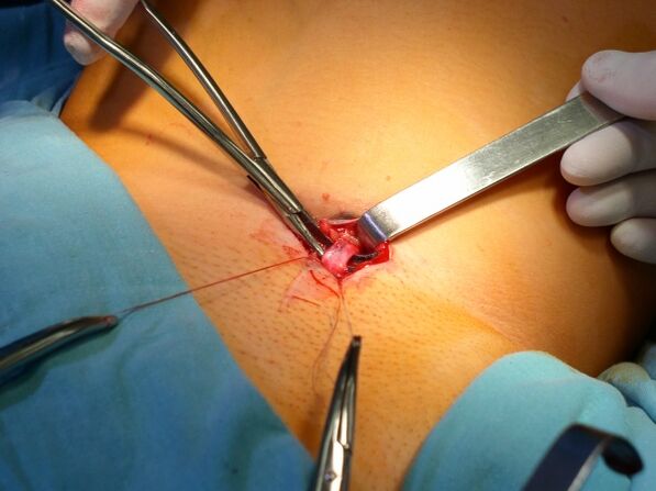 surgery