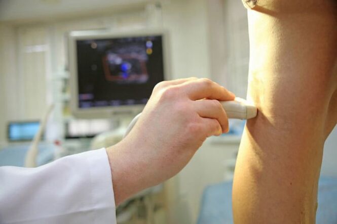 Ultrasound vein